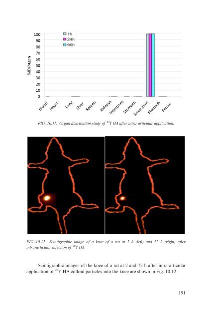 Yttrium-90 and Rhenium-188 Radiopharmaceuticals for Radionuclide Therapy