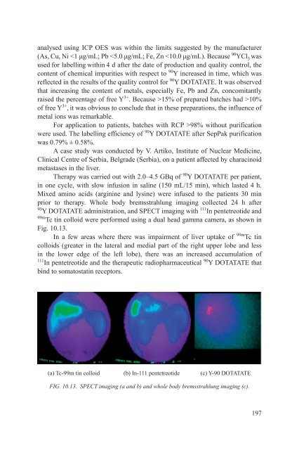 Yttrium-90 and Rhenium-188 Radiopharmaceuticals for Radionuclide Therapy