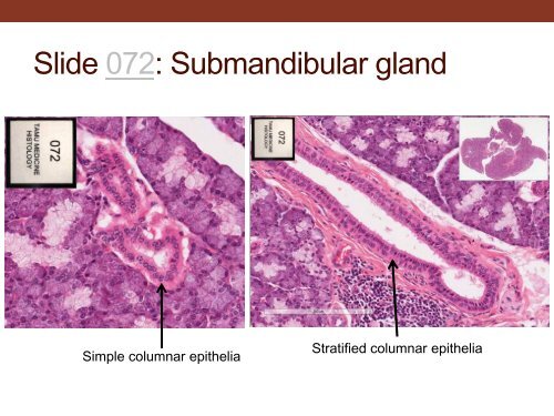 EPITHELIUM AND GLANDS