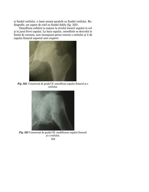 CarteaOrtopedietraumatologie