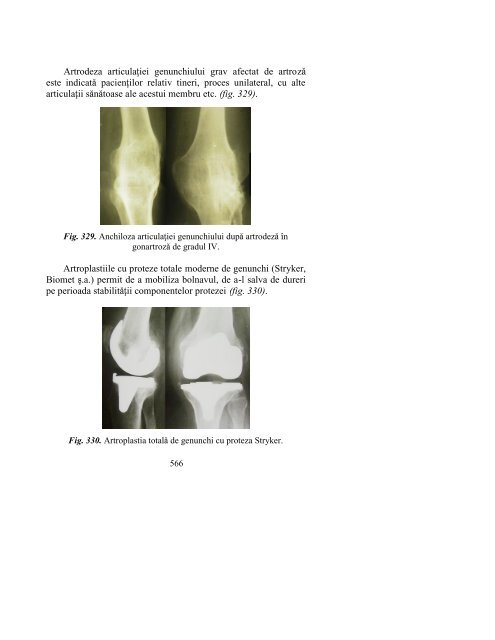 CarteaOrtopedietraumatologie