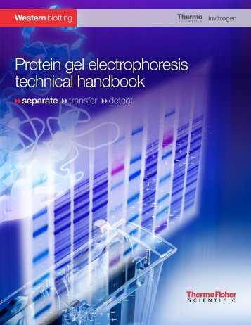 Protein gel electrophoresis technical handbook