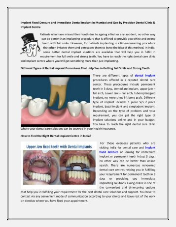 Implant Fixed Denture and Immediate Dental Implant in Mumbai and Goa by Precision Dental Clinic & Implant Centre