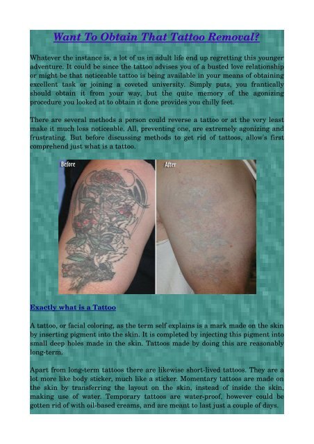 Does Tattoo Removal Leave a Scar Behind?: Bruce Sanderson, MD: Laser &  Medical Spa