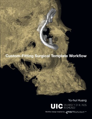 Surgical Guide Workflow