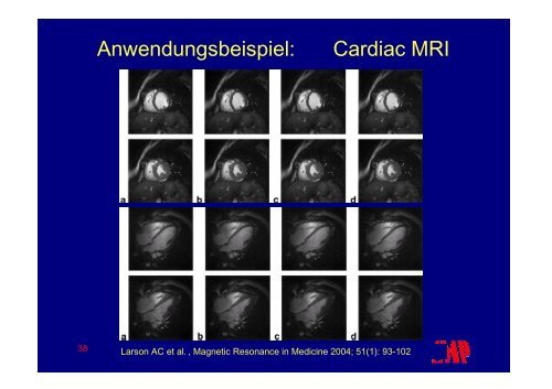 PowerPoint - MR Imaging - Instituts für Medizinische Physik