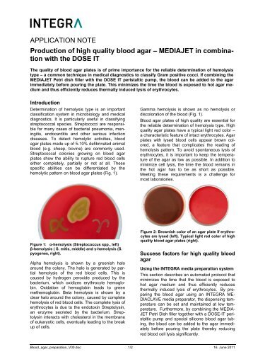 MEDIAJET in combina- tion with the DOSE IT - INTEGRA Biosciences