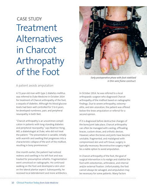 Treatment Alternatives in Charcot Arthropathy of the Foot