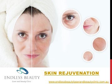 Skin Rejuvenation - Endless Beauty