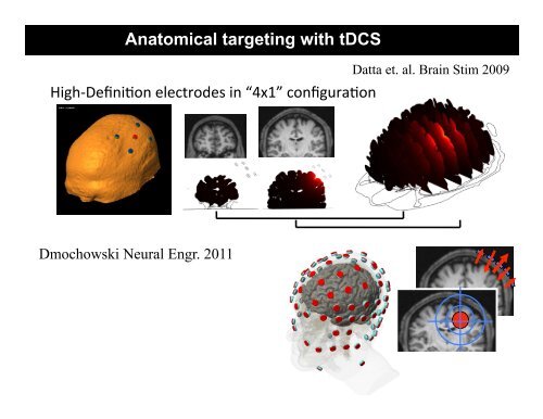 Direct Current Stimulation (HD-tDCS)