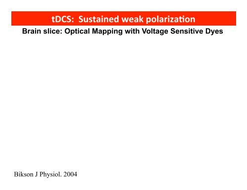 Direct Current Stimulation (HD-tDCS)