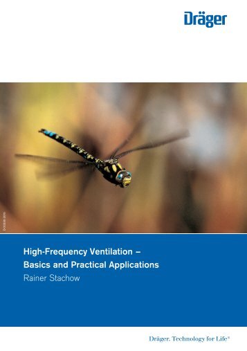 High-Frequency Ventilation- Basics and Practical Applications