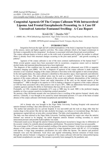 Congenital Agenesis Of The Corpus Callosum With Intracerebral Lipoma And Frontal Encephalocele Presenting As A Case Of Unresolved Anterior Fontannel Swelling: A Case Report