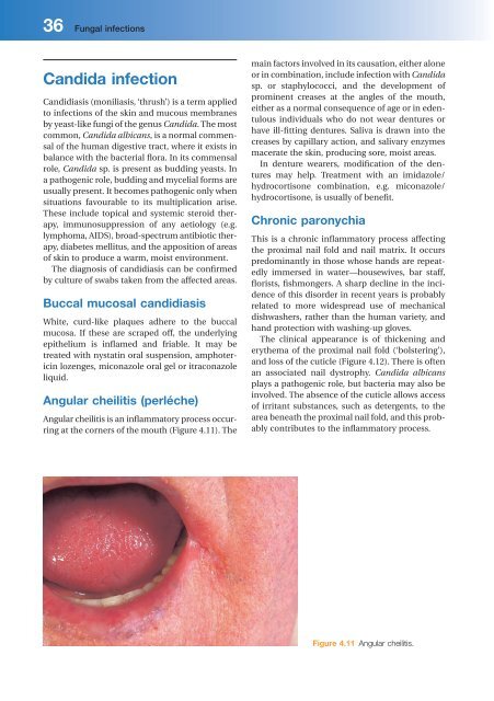 Lecture Notes Dermatology - Graham-Brown, Robin, Burns, Tony