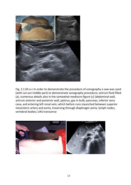 Greiner-Ultrasound-Leseprobe