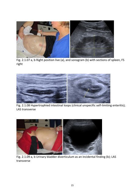 Greiner-Ultrasound-Leseprobe