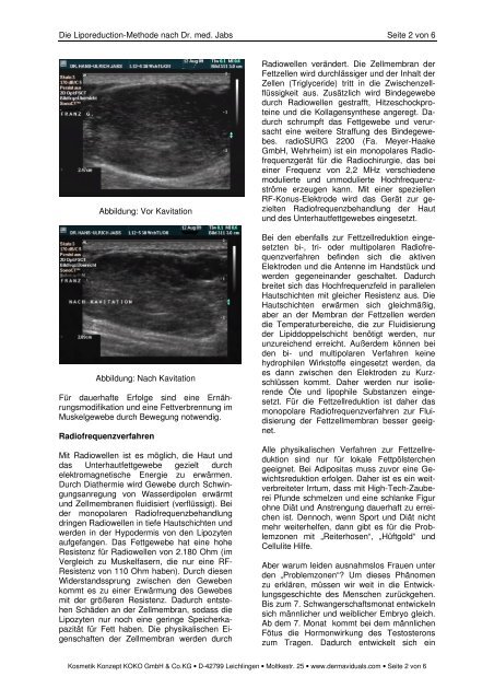 Schumann-Schwingungen, Radiowellen und ... - Dermaviduals