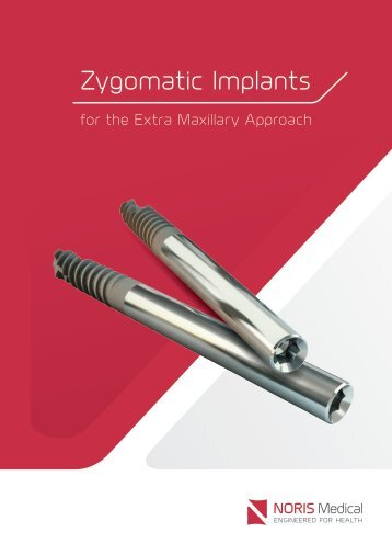 Zygomatic Implants - Noris Medical