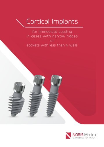 Cortical Implants Brochure - Noris Medcical 