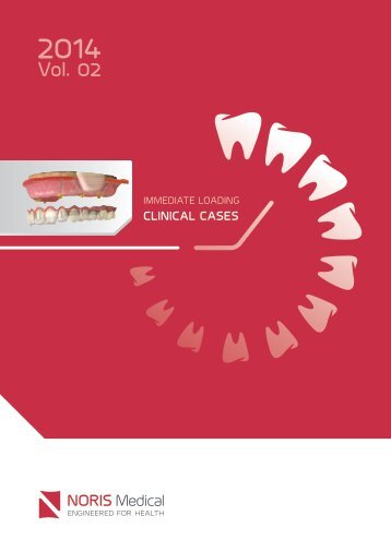 Immediate Loading Clinical cases 30.6.14 