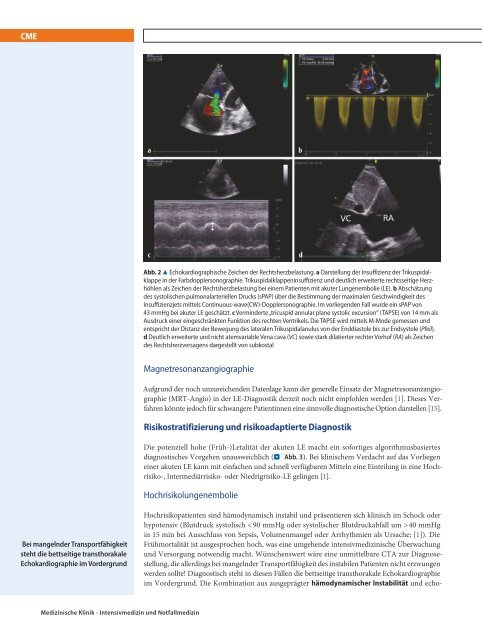 Lungenembolie CME 2016