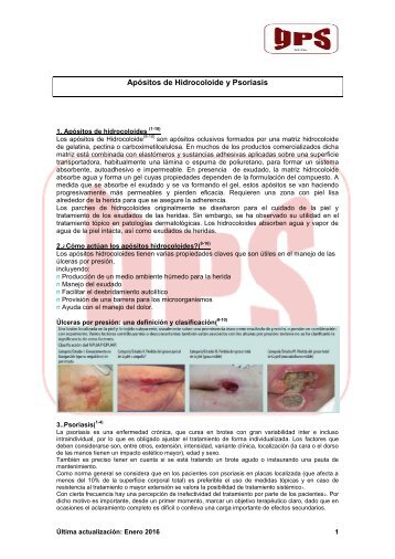 Apósitos de Hidrocoloide y Psoriasis