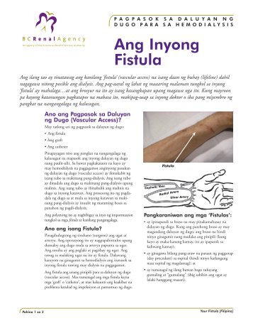 Ang Inyong Fistula - BC Provincial Renal Agency