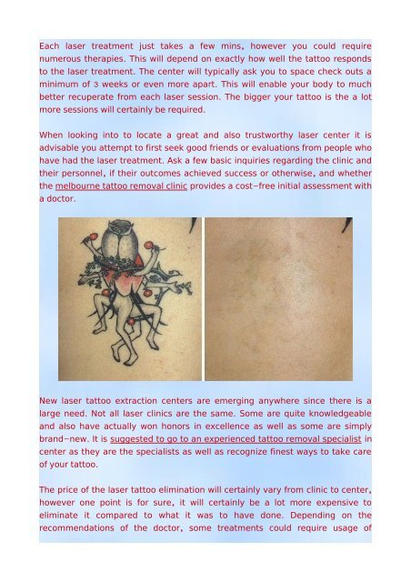 How To Selecting A Tattoo Removal Laser Clinic