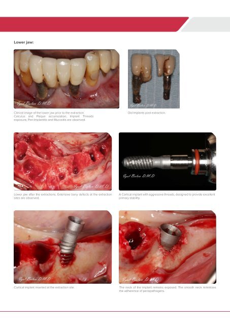 clinica case 30.6.14 print