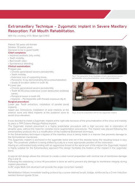 clinica case 30.6.14 print