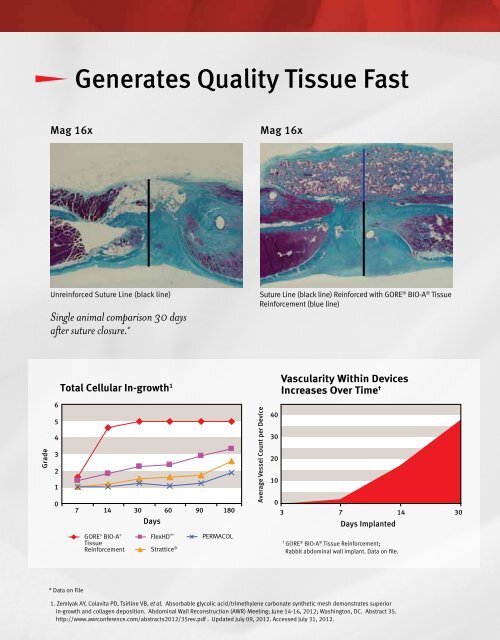 GORE BIO-A Tissue Reinforcement 