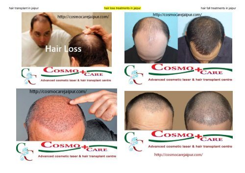 Cosmo Care Hair Transplant Cosmo Care Hair Transplant