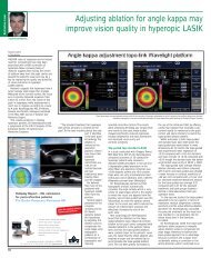 Adjusting ablation for angle kappa may - European Society of ...