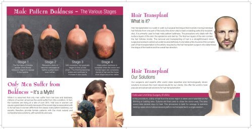 Hair transplant