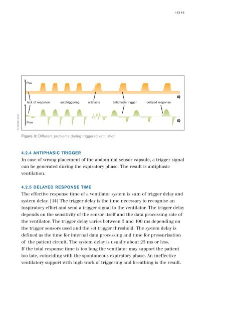 Pressure Support Ventilation - A New Triggered Venilation Mode for Neonates