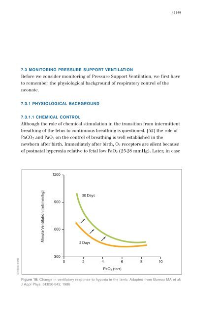 Pressure Support Ventilation - A New Triggered Venilation Mode for Neonates