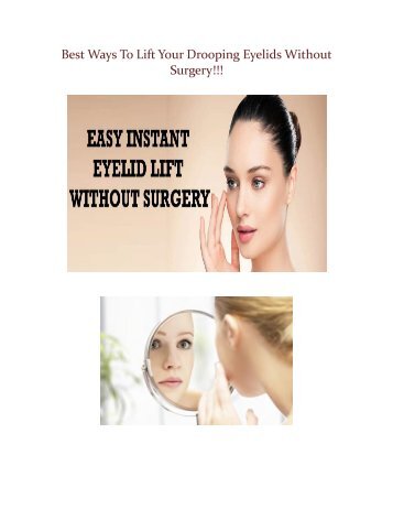 Best Ways To Lift Your Drooping Eyelids Without Surgery!!!