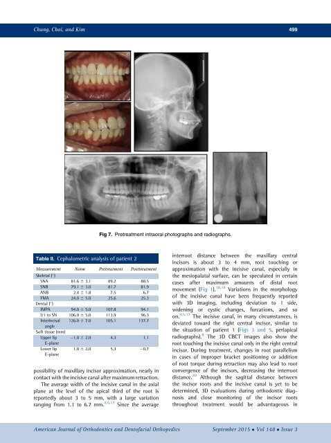 Approximation and contact of the maxillary central incisor roots with the incisive canal after maximum retraction with temporary anchorage devices_ Report of 2 patients