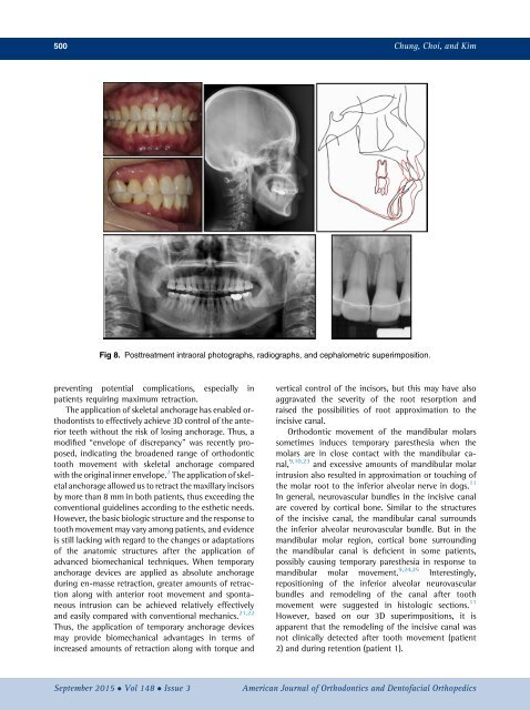 Approximation and contact of the maxillary central incisor roots with the incisive canal after maximum retraction with temporary anchorage devices_ Report of 2 patients