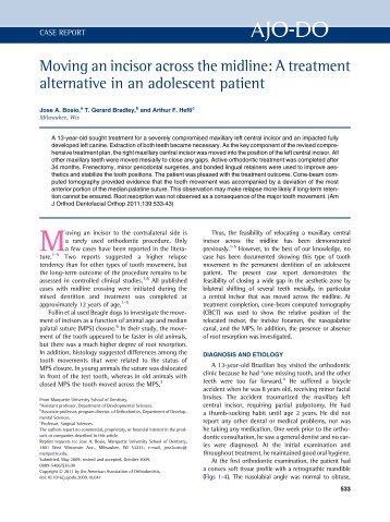 Moving an incisor across the midline_ A treatment alternative in an adolescent patient