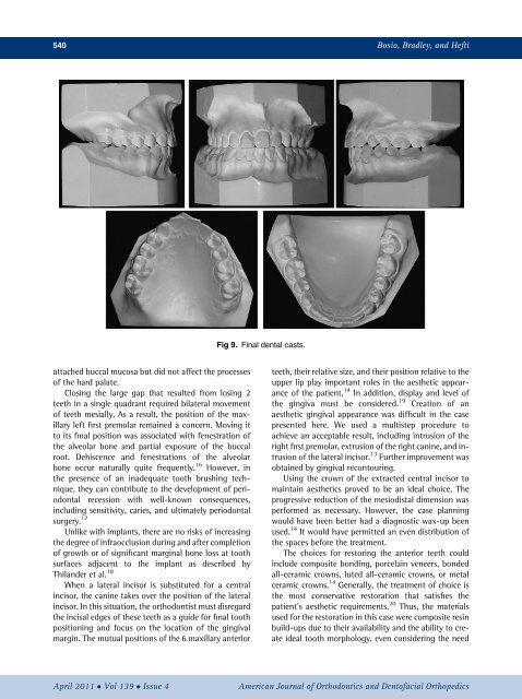 Moving an incisor across the midline_ A treatment alternative in an adolescent patient
