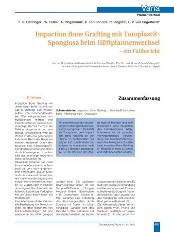 Impaction Bone Grafting mit Tutoplast®- Spongiosa beim ...