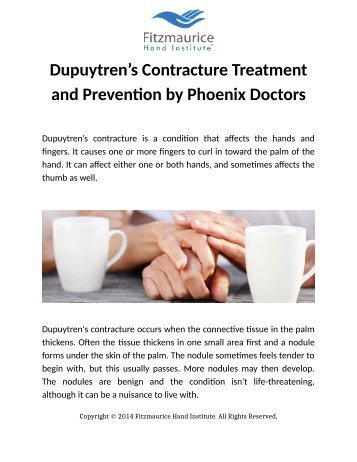 Dupuytren’s Contracture Treatment and Prevention by Phoenix Doctors