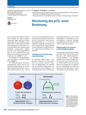 Monitoring PCO2 Magnet