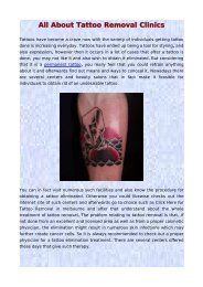 All About Tattoo Removal Clinics