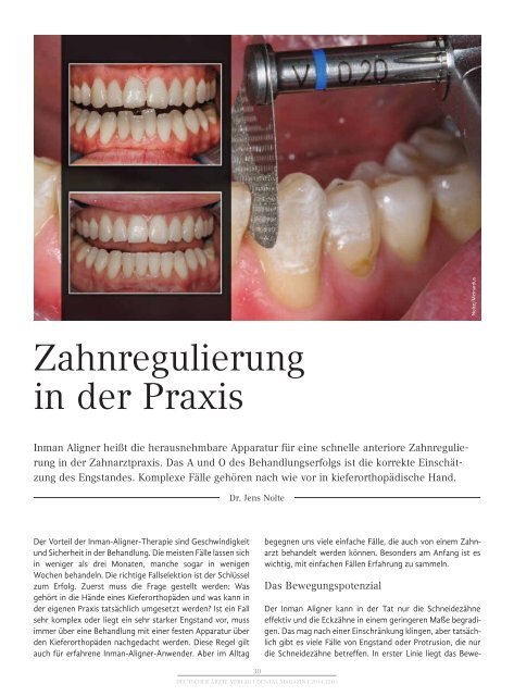 Dr. Nolte - Dental Magazin 01-2014 -Zahnregulierung in der Praxis