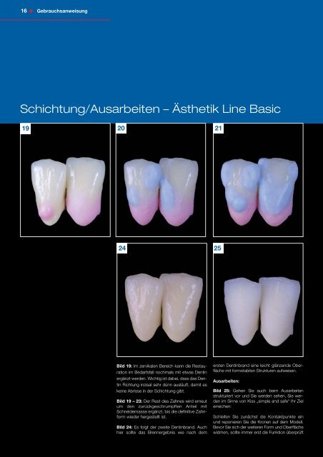 Cercon ceram kiss Broschüre - DeguDent GmbH