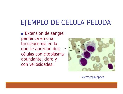 ALTERACIONES GENETICAS DE LEUCOCITOS woek