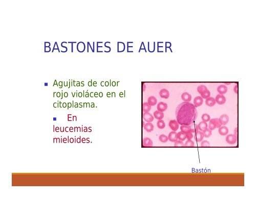 ALTERACIONES GENETICAS DE LEUCOCITOS woek