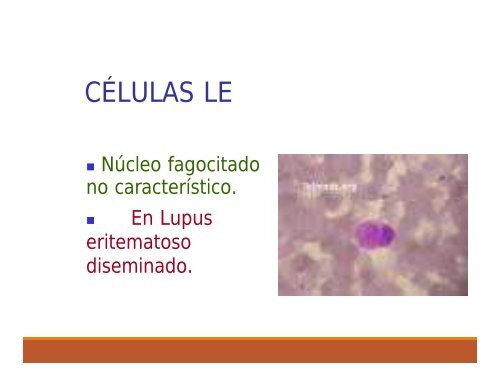 ALTERACIONES GENETICAS DE LEUCOCITOS woek